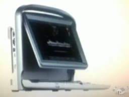 ECOGRAFO COLOR DOPPLER CON DOS TRANSDUCTORES MAS BATERIA 8,990 USD